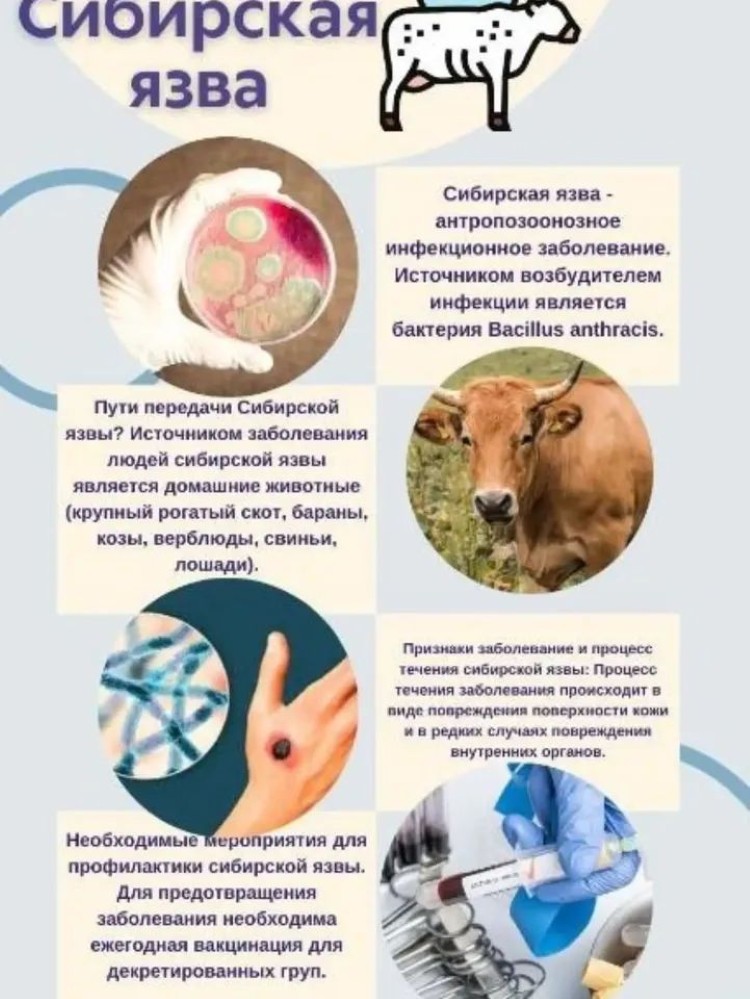 Сібір жарасы